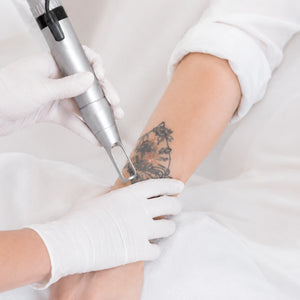 Prismelis Multi-Wavelength Nd:YAG Laser System - main 5