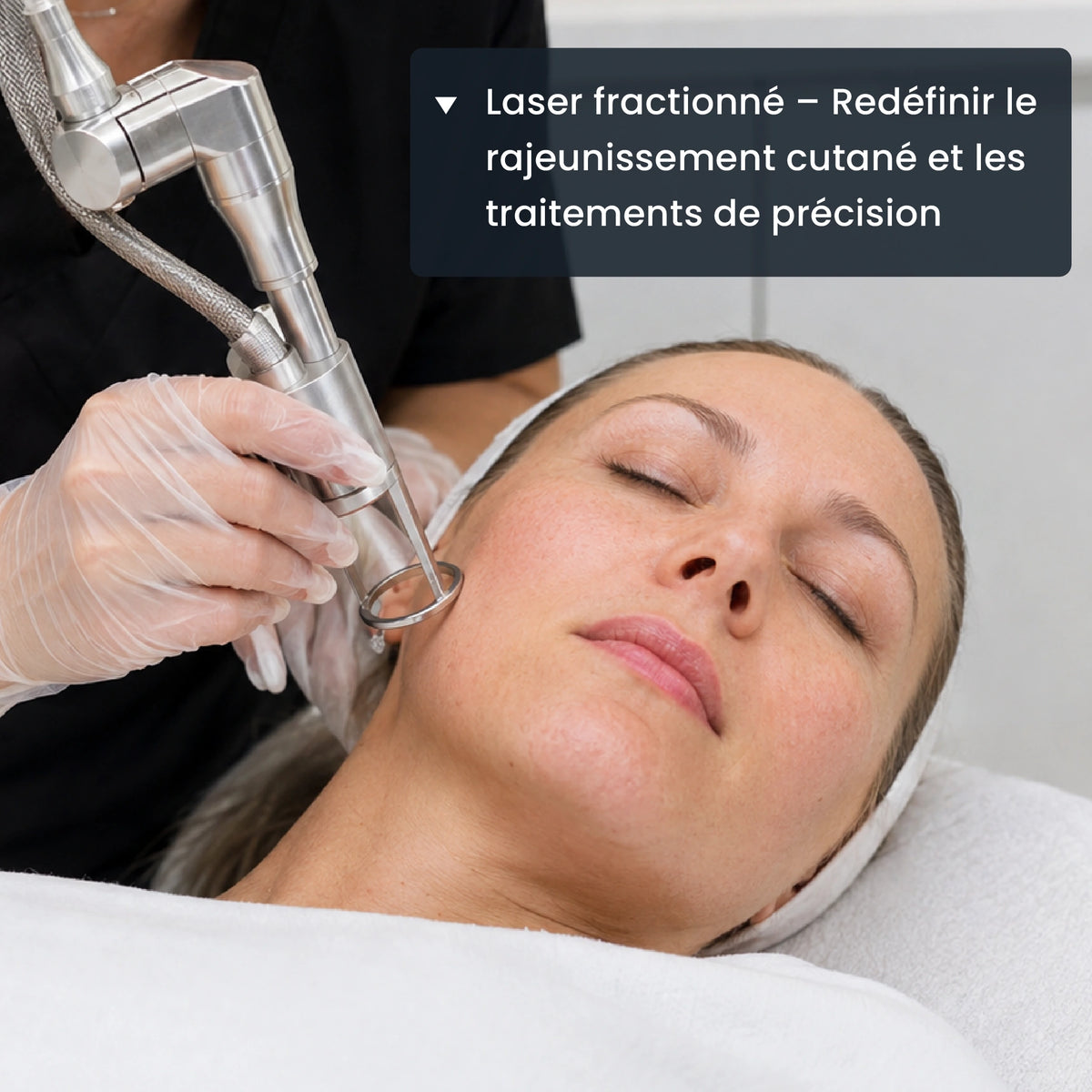 Laser fractionné : resurfaçage cutané de précision