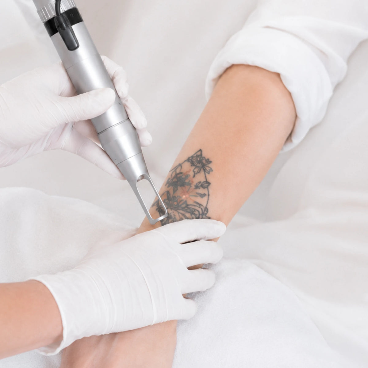Prismelis Multi-Wavelength Nd:YAG Laser System - main 5
